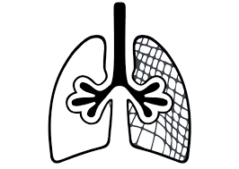 Chronic obstructive pulmonary disease (copd). Copd Animal Models Scireq