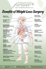 Pin On Sleep Apnea In Babies