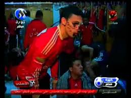 وقد علق على احداث مباراة الاهلي والمصري في بورسعيد عدد من اللاعبين حيث قال ابو تريكة ان الاعتداء مازال مستمرا الى الان وصرح محمد بركات ان السعي وراء الاموال هو الذي ادى لمثل احداث بورسعيد هذه كما اعلن عماد متعب انه سوف يعتزل مؤقتا لحين عودة الامن وتوفر امكانية. ÙØµØ§Ø¨ÙÙ ÙÙØªÙÙ ÙÙ ØºØ±ÙØ© ÙÙØ§Ø¨Ø³ Ø§ÙØ£ÙÙÙ Youtube