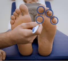 Image result for diabetic toes