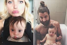 Bebê de 11 meses com Síndrome de Down "assina" contrato com agência e se  torna modelo como a mãe