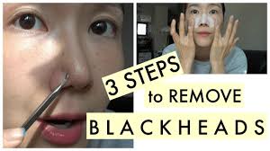 How To Remove Blackheads Without Enlarging Pores What Are Blackheads Whiteheads Youtube