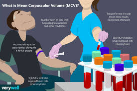 Mean Corpuscular Volume Mcv Uses Side Effects Procedure And Results