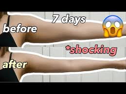 Slimmer Arms – Prettylooks Aesthetic Center