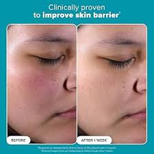 Amazon.com: Paulas Choice-SKIN PERFECTING 2% BHA Liquid Salicylic Acid  Exfoliant-Facial Exfoliant for Blackheads, Enlarged Pores, Wrinkles & Fine  ...