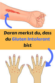 S'abonner s'abonner s'abonner s'abonner s'abonner s'abonner. Bist Du Glutenintolerant Achte Auf Die Warnhinweise Deines Korpers Glutenfreie Rezepte Glutenfrei Backen Glutenfrei Rez Gluten Intolerance Intolerance Food