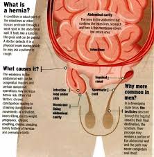 The lining of the uterus. Female Anatomy Groin Anatomy Drawing Diagram