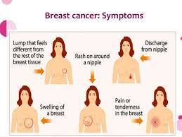 Be aware of breast cancer signs and symptoms. Breast Cancer Awareness And Prevention