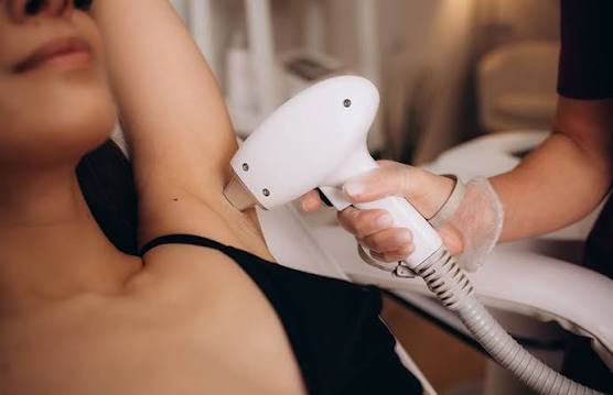Laser Hair Removal in New Cairo 2026: Complete Guide for Women
