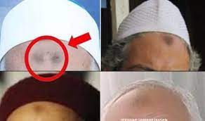 Cara turun sujud sesuai sunnah (2019) berikut. Hitam Di Dahi Tanda Riak Dan Solat Tidak Sempurna