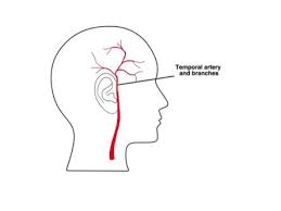 Image result for Jaw Claudication