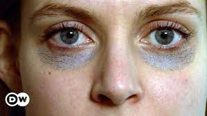 انتفاخ أسفل العين ظاهرة مزعجة تخلص منها بخطوات بسيطة صحة معلومات لا بد منها لصحة أفضل dw 05 03 2021