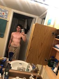 One Month Post Op Dr Turkeltaub Ftm To reach our community, please contact us for information about advertising. one month post op dr turkeltaub ftm