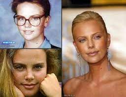 chatter busy charlize theron plastic surgery plastic surgery celebrity plastic surgery acne on nose