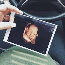 Pin On Pregnancy