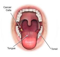 We did not find results for: Tonsil Berbahaya Jika Tidak Di Cegah Ini Punca Dan Rawatannya