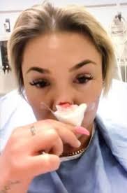 Dramat pięknej blondynki. W sylwestra chłopak odgryzł jej nos!