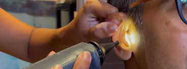 Does Ohip Cover Hearing Aids & More Hearing Aid Questions