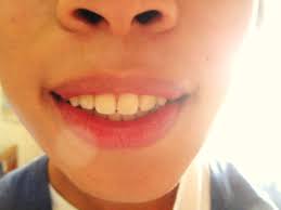 You Calling My Teeth Ugly!?