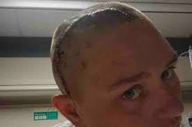 Fundraiser by Steve Standley : Helping Debra get her life back from her  seizures.