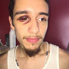 NYPD cop charged with assaulting Coney Island man over spilled drink enters  not guilty plea