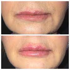 Reviews for anna stephens aesthetics, llc · feb 2022. Anna Stephens Aesthetics In Ruston La Styles Vagaro