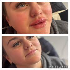 Chloe Willis Aesthetics