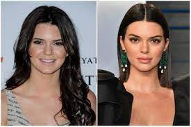Kendal jenner is still 19 years old. Has Kendall Jenner Had Plastic Surgery Quora