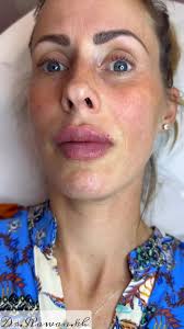 Rawan ALkhateeb (@dr.rawan.alkhateeb) • Instagram photos and videos