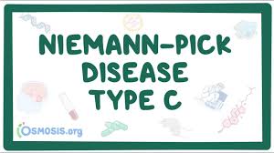 Type a, type b, type c1, and type c2. Niemann Pick Disease Type C Causes Symptoms Diagnosis Treatment Pathology Youtube