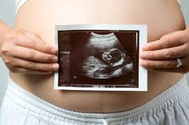 A dating scan is an ultrasound scan to determine how many weeks pregnant you are and your due date. Baby Waves During Ultrasound Synergy Radiology