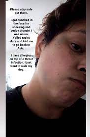 Indigenous Woman Says Man Punched Her Told Her To Go Back To Asia Vancouver Is Awesome