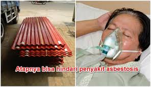 Ketimbang jenis atap rumah yang lainnya, seperti atap alderon atau asbes, atap dari fiber jauh lebih aman untuk digunakan, tidak berbahaya dan memiliki durabilitas yang prima terhadap berbagai macam kondisi cuaca sehingga sangat cocok digunakan di hunian yang berada di iklim tropis seperti di indonesia. Tak Hanya Melindungi Atap Atap Ini Juga Bisa Jauhkan Pemilik Rumah Dari Hal Mematikan Boombastis