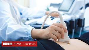 Pelbagai ragam pesakit di klinik swasta. Dokter Kandungan Asal Portugal Dihukum Skorsing Setelah Bayi Lahir Tanpa Wajah Bbc News Indonesia