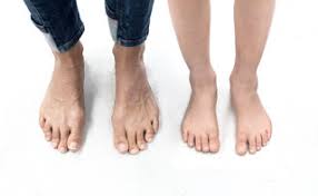 Check spelling or type a new query. Male Female Celebrities With Ugly Feet