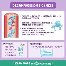 Image result for Decompression Sickness Management