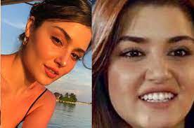 Burcu özberk, yıllar öncesine ait estetiksiz fotoğraflarıyla şoke etti. Afili Ask In Ayse Si Burcu Ozberk In Estetiksiz Hali Sok Etti