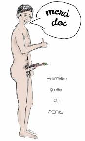 Résultat de recherche d'images pour "greffe de pénis"