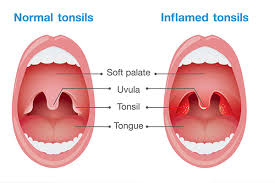 Image result for Adenodolichos