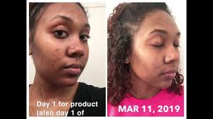Urban skin rx even tone cleansing bar goes above and beyond the typical cleanser. Urban Skin Rx Clear Skin Cleansing Bar Clear Tone Youtube