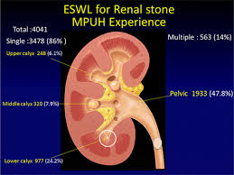 The framework of the bones is called the skeleton; Scientific Program For 31st World Congress Of Endourology Swl Program Book Journal Of Endourology