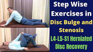 In this article, learn what causes disks to slip, how to prevent this, and what complications can arise. Exercises For Herniated Disc Disc Bulge L4 L5 S1 Step Wise Treatment For Slipped Disc Recovery Youtube