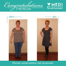 Pin On Before After