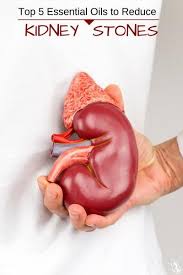 Top 5 Essential Oils To Reduce Kidney Stones Chronic Kidney Disease Diabetic Nephropathy Kidney Failure Symptoms