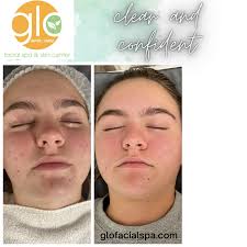 Acne and Graceful Aging Specialist