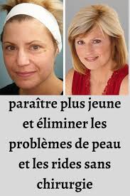 Epingle Sur Beaute Du Visage