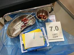 How to apply for pr in malaysia? Klinik Prp Platelet Rich Plasma Treatment Malaysia Home Facebook