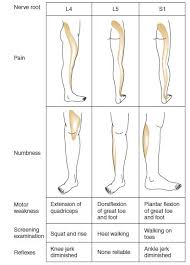 Image result for Low Back Standing Exam