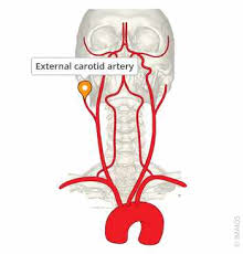Image result for carotid artery