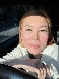 💙 HarmonyCa 🧡 พร้ือมให้บริการทุกสาขา ผลลัพธ์ยาวนาน 18 เดือน  ขอบคุณรีวิวจากคุณนุ่นค่ะ